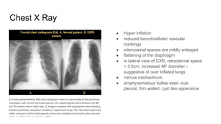 COPD and GOLD guidelines and management.pptx