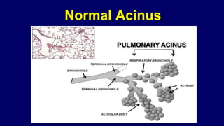 Normal Acinus
 