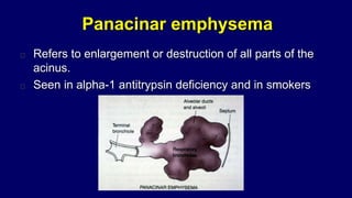 Panacinar emphysema
Refers to enlargement or destruction of all parts of the
acinus.
Seen in alpha-1 antitrypsin deficiency and in smokers
 