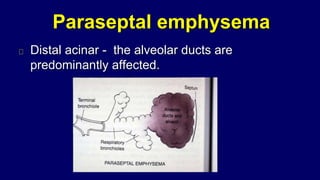 Paraseptal emphysema
Distal acinar - the alveolar ducts are
predominantly affected.
 