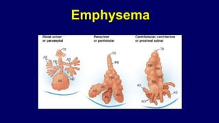 Emphysema
 
