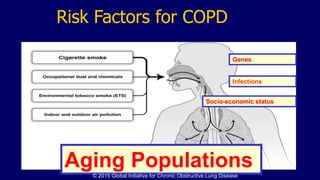 Risk Factors for COPD
Genes
Infections
Socio-economic status
Aging Populations© 2015 Global Initiative for Chronic Obstructive Lung Disease
 