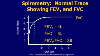 Spirometry: Normal Trace
Showing FEV1 and FVC
1 2 3 4 5 6
1
2
3
4
Volume,liters
Time, sec
FVC5
1
FEV1 = 4L
FVC = 5L
FEV1/FVC = 0.8
© 2015 Global Initiative for Chronic Obstructive Lung Disease
 