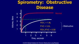 Spirometry: Obstructive
Disease
Volume,liters
Time, seconds
5
4
3
2
1
1 2 3 4 5 6
FEV1 = 1.8L
FVC = 3.2L
FEV1/FVC = 0.56
Normal
Obstructive
© 2015 Global Initiative for Chronic Obstructive Lung Disease
 