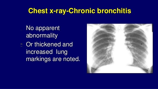 COPD (Chronic obstructive Pulmonary Disease) PowerPoint 