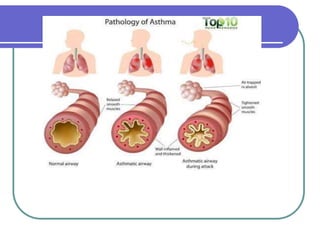COPD & asthma.ppt