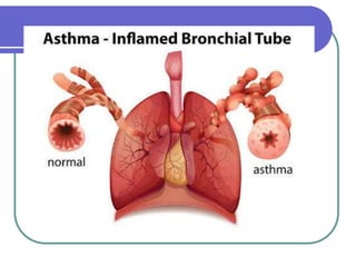 COPD & asthma.ppt