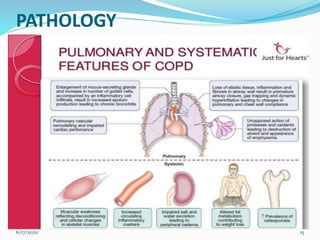 PATHOLOGY
6/17/2020 15
 