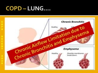 C
O
P
D
R
E
C
E
N
T
2
0
2
0
 