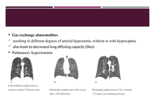  Gas exchange abnormalities
 resulting in different degrees of arterial hypoxemia, without or with hypercapnia.
 also leads to decreased lung diffusing capacity (Dlco)
 Pulmonary hypertension
Centrilobular emphysema in
chronic smoker (70 pack year) Panlobular emphysema with severe Paraseptal emphysema in 56 yr female
alfa-1 AT deficiency. (37 pack year smoking history)
 