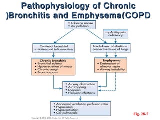 Pathophysiology of Chronic
(Bronchitis and Emphysema(COPD




                          Fig. 28-7
 