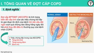Antibiotics use in COPD acute exacerbation | PPTX