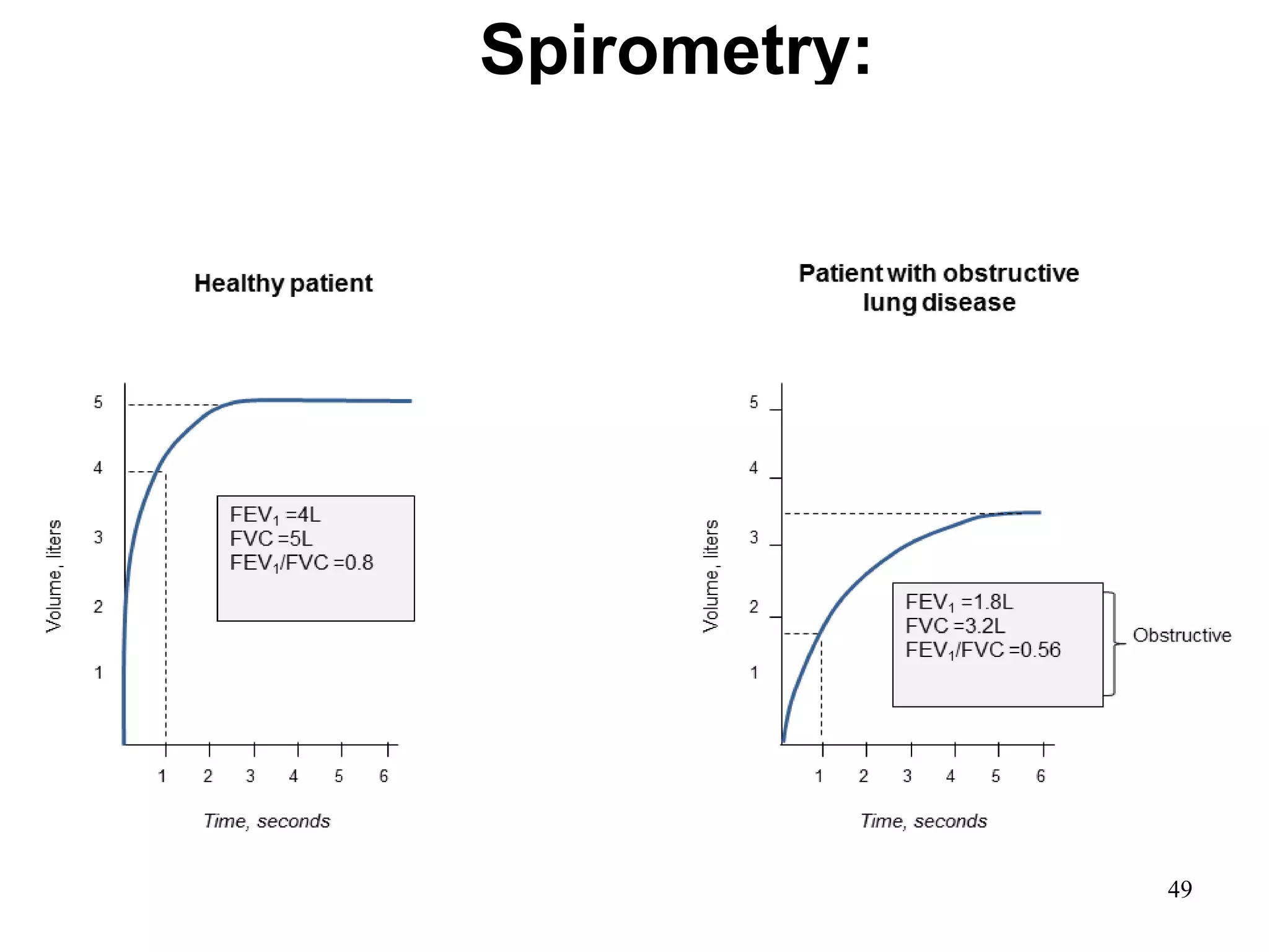 Spirometry:
Volume,liters
Time, seconds
5
4
3
2
1
1 2 3 4 5 6
© 2014 Global Initiative for Chronic Obstructive Lung Disease
49
 