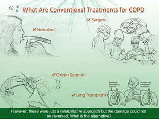 COPD PPT