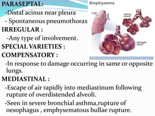 PARASEPTAL:
-Distal acinus near pleura
- Spontaneous pneumothorax.
IRREGULAR :
-Any type of involvement.
SPECIAL VARIETIES :
COMPENSATORY :
-In response to damage occurring in same or opposite
lungs.
MEDIASTINAL :
-Escape of air rapidly into mediastinum following
rupture of overdistended alveoli.
-Seen in severe bronchial asthma,rupture of
oesophagus , emphysematous bullae rupture.
 