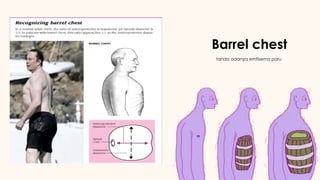 Chronic Obstructive Pulmonary Disease (COPD) | PPTX