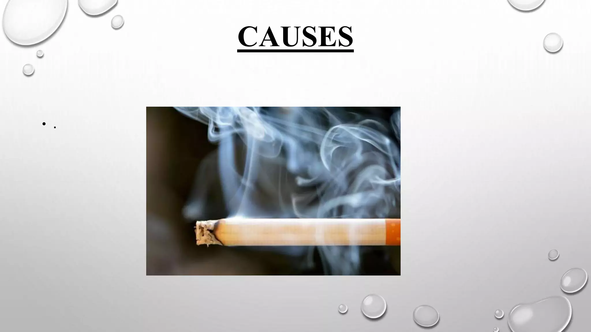 CAUSES
• .
 