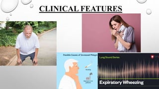 CLINICAL FEATURES
 