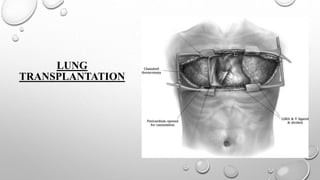 LUNG
TRANSPLANTATION
 