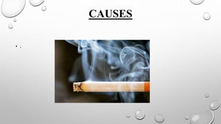 CAUSES
• .
 