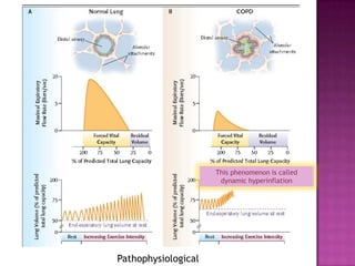 This phenomenon is called
                      dynamic hyperinflation




Pathophysiological
 
