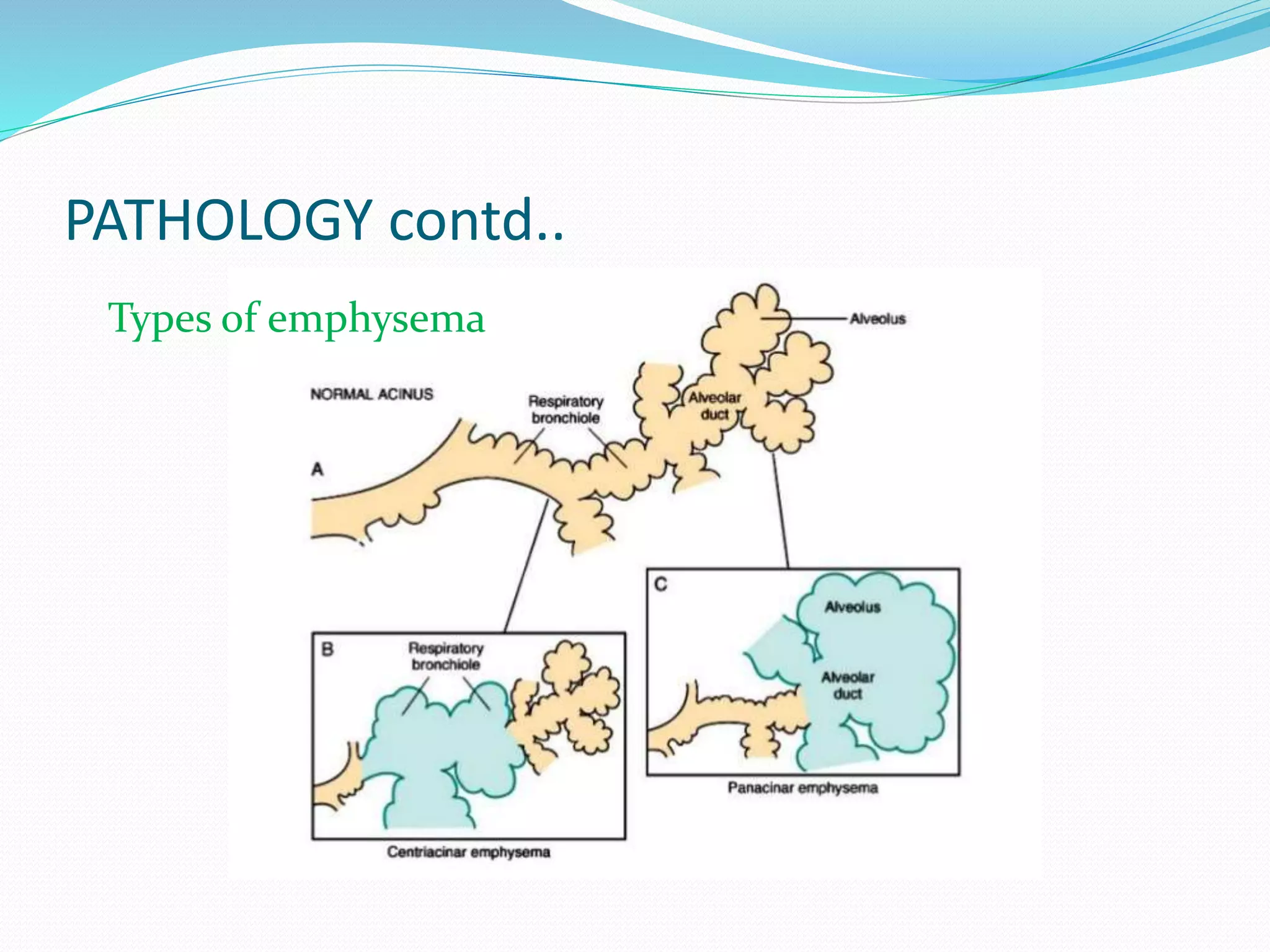 PATHOLOGY contd..
Types of emphysema
 