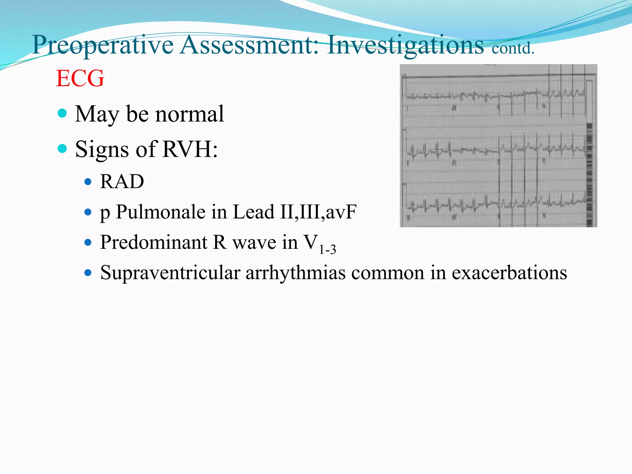 Preoperative Assessment: Investigations contd.
ECG
 May be normal
 Signs of RVH:
 RAD
 p Pulmonale in Lead II,III,avF
 Predominant R wave in V1-3
 Supraventricular arrhythmias common in exacerbations
 