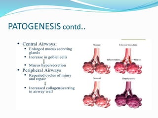 PATOGENESIS contd..
 