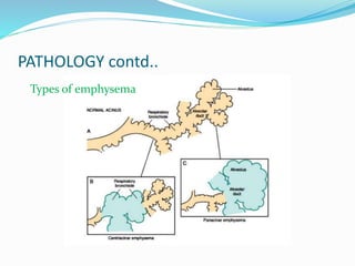 PATHOLOGY contd..
Types of emphysema
 