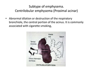 Subtype of emphysema.
Centrilobular emphysema (Proximal acinar)
• Abnormal dilation or destruction of the respiratory
bronchiole, the central portion of the acinus. It is commonly
associated with cigarette smoking,
 