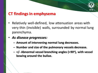 CT findings in emphysema
• Relatively well-defined, low attenuation areas with
very thin (invisible) walls, surrounded by normal lung
parenchyma.
• As disease progresses:
– Amount of intervening normal lung decreases.
– Number and size of the pulmonary vessels decrease.
– +/- Abnormal vessel branching angles (>90o), with vessel
bowing around the bullae.
 