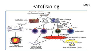 SLIDE 6
Patofisiologi
 