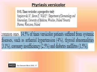Ptyriasis versicolor
 