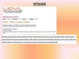 VITILIGO
 