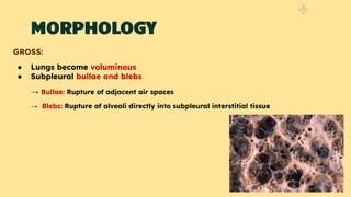 COPD_ Types, Risk Factors & Morphology.pdf