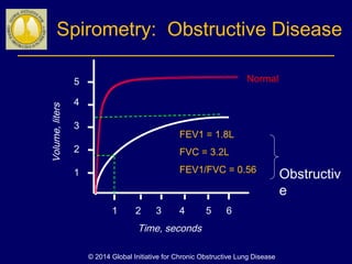 Spirometry: Obstructive Disease
Volume,liters
Time, seconds
5
4
3
2
1
1 2 3 4 5 6
FEV1 = 1.8L
FVC = 3.2L
FEV1/FVC = 0.56
Normal
Obstructiv
e
© 2014 Global Initiative for Chronic Obstructive Lung Disease
 