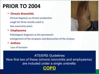 PRIOR TO 2004
• Chronic Bronchitis
Clinical diagnosis as chronic productive
cough for three months each in
two successive years.
• Emphysema
Pathological diagnosis as the permanent
enlargement of the airspaces and destruction of the airways
• Asthma
Loss of function
ATS/ERS Guidelines
Now first two of these (chronic bronchitis and emphysema)
are included under a single umbrella
COPD
 