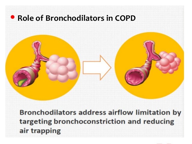 Optimising treatment for COPD