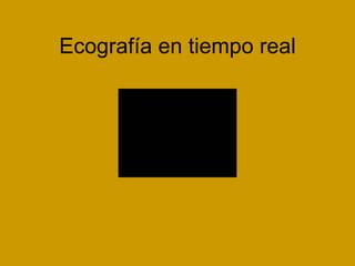 Ecografía en tiempo real 