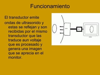 Funcionamiento El transductor emite ondas de ultrasonido y  estas se reflejan y son recibidas por el mismo transductor que las traduce aun voltaje que es procesado y genera una imagen que se aprecia en el monitor. 