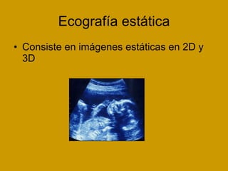 Ecografía estática Consiste en imágenes estáticas en 2D y 3D  