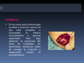<ul><li>NORMA 8: </li></ul><ul><li>En los casos que la hemorragia se deba a inversión uterina ya sea está completa o incom...