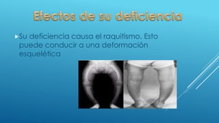 Su deficiencia causa el raquitismo. Esto
puede conducir a una deformación
esquelética
 