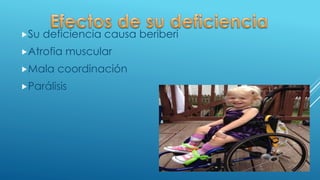 Su deficiencia causa beriberi
Atrofia muscular
Mala coordinación
Parálisis
 