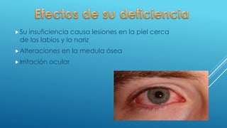 Su insuficiencia causa lesiones en la piel cerca
de los labios y la nariz
Alteraciones en la medula ósea
Irritación ocular
 