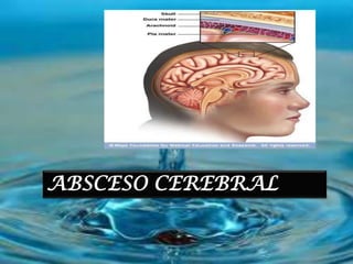 ABSCESO CEREBRAL
 