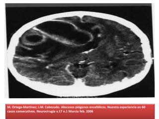 M. Ortega-Martínez; J.M. Cabezudo. Abscesos piógenos encefálicos. Nuestra experiencia en 60
casos consecutivos. Neurocirugía v.17 n.1 Murcia feb. 2006
 