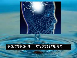 EMPIEMA   SUBDURAL
 