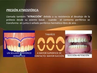PRESIÓN ATMOSFÉRICA:
Llamada también “ATRACCIÓN” debido a su resistencia al desalojo de la
prótesis desde su asiento basal, cuando el contorno periférico se
transforma en junta ó sellado periférico hermético libre de aire .
UN SELLADO PERIFÉRICO
HERMÉTICO
A MAYOR SUPERFICIE DE
CONTACTO- MAYOR SUCCIÓN SUCCIÓN=RETENCIÓN
 