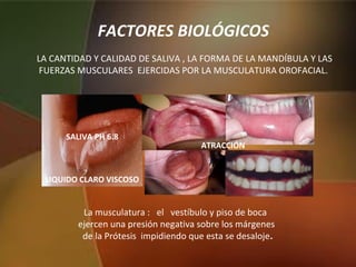 FACTORES BIOLÓGICOS
LA CANTIDAD Y CALIDAD DE SALIVA , LA FORMA DE LA MANDÍBULA Y LAS
FUERZAS MUSCULARES EJERCIDAS POR LA MUSCULATURA OROFACIAL.
La musculatura : el vestíbulo y piso de boca
ejercen una presión negativa sobre los márgenes
de la Prótesis impidiendo que esta se desaloje.
SALIVA PH 6.8
LIQUIDO CLARO VISCOSO
ATRACCIÓN
 